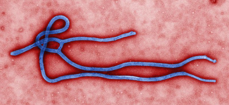 Virus Ebola dưới kính hiển vi điện tử